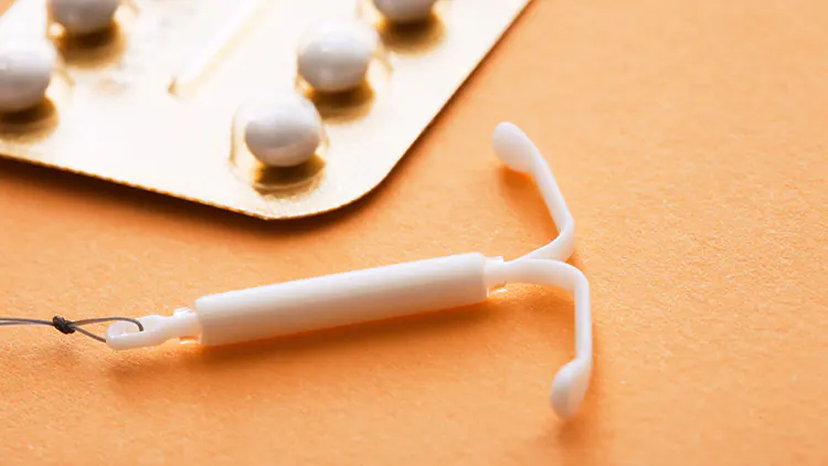 mirena-iud-side-effects-insertion-gold-coast
